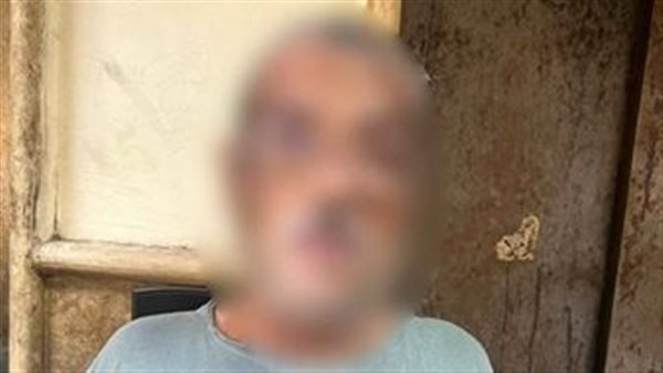 تفاصيل مشاجرة الجمالية بسبب وضع البضائع أمام الورشة وانتهت بإلقاء مادة كاوية